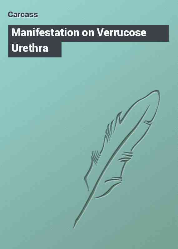 Manifestation on Verrucose Urethra